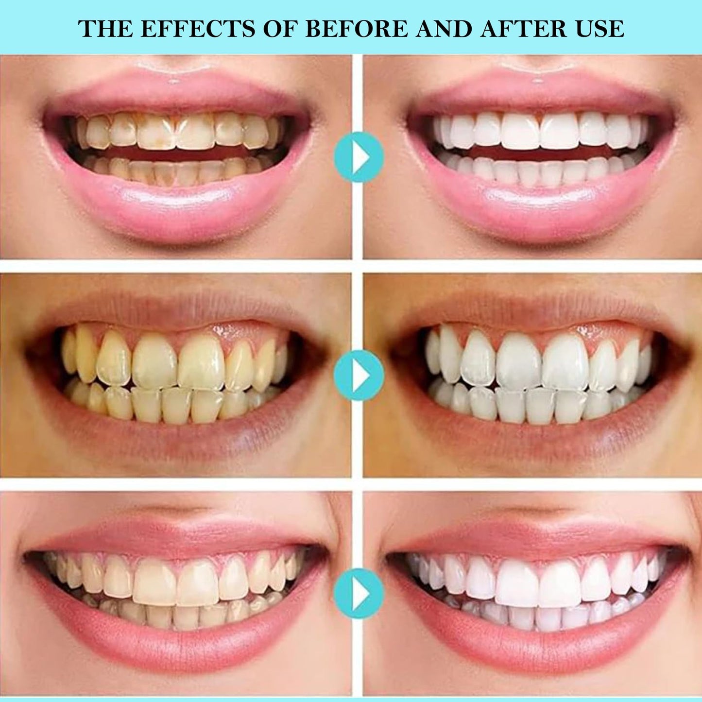 Ayzololo Niacinamide Whitening Toothpaste,Fresh Breath,Remove Tooth Stains,3.53 oz/ 100g
